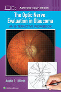 THE OPTIC NERVE EVALUATION IN GLAUCOMA AN INTERACTIVE WORKBOOK (PB 2017)