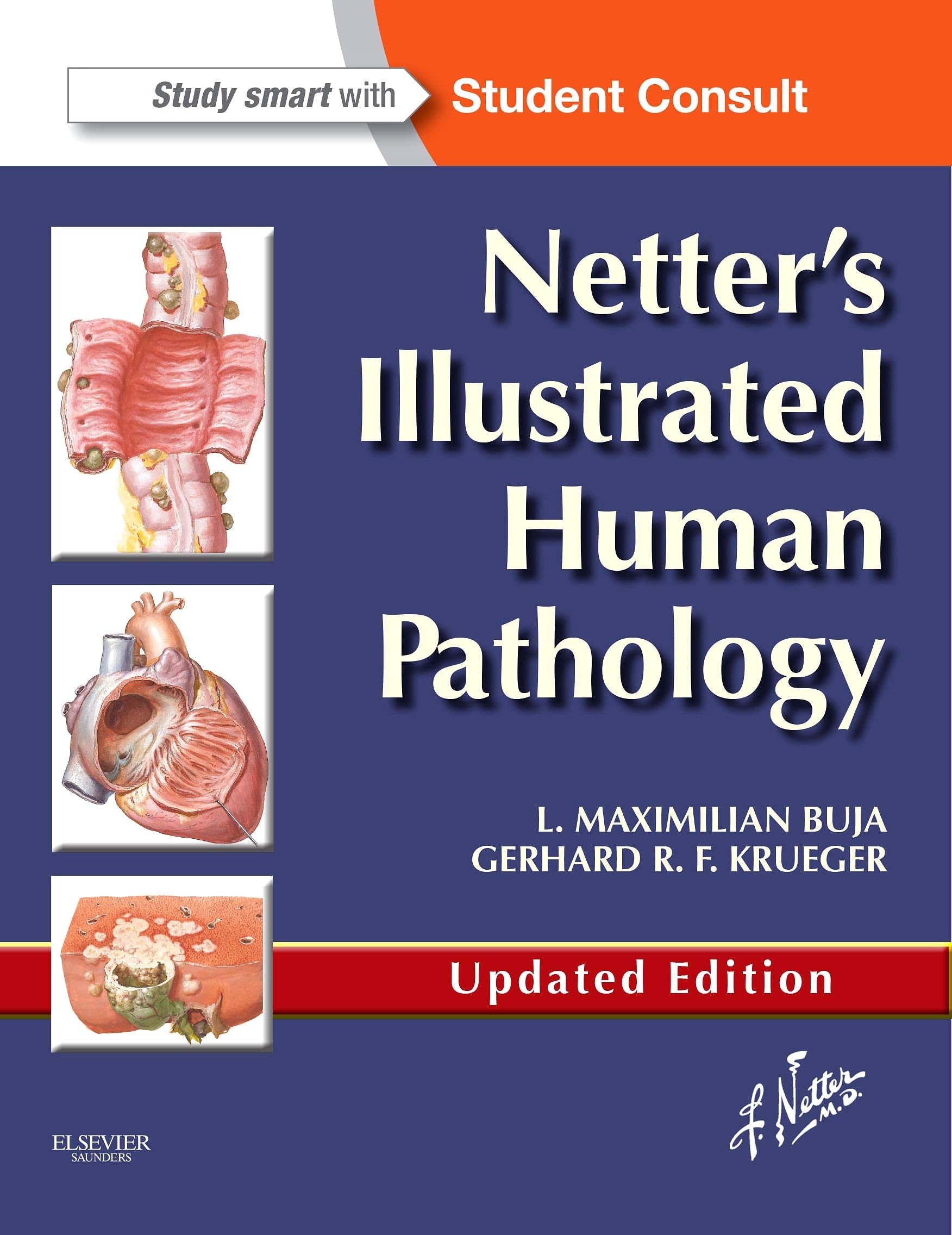 Netters Illustrated Human Pathology Updated Edition