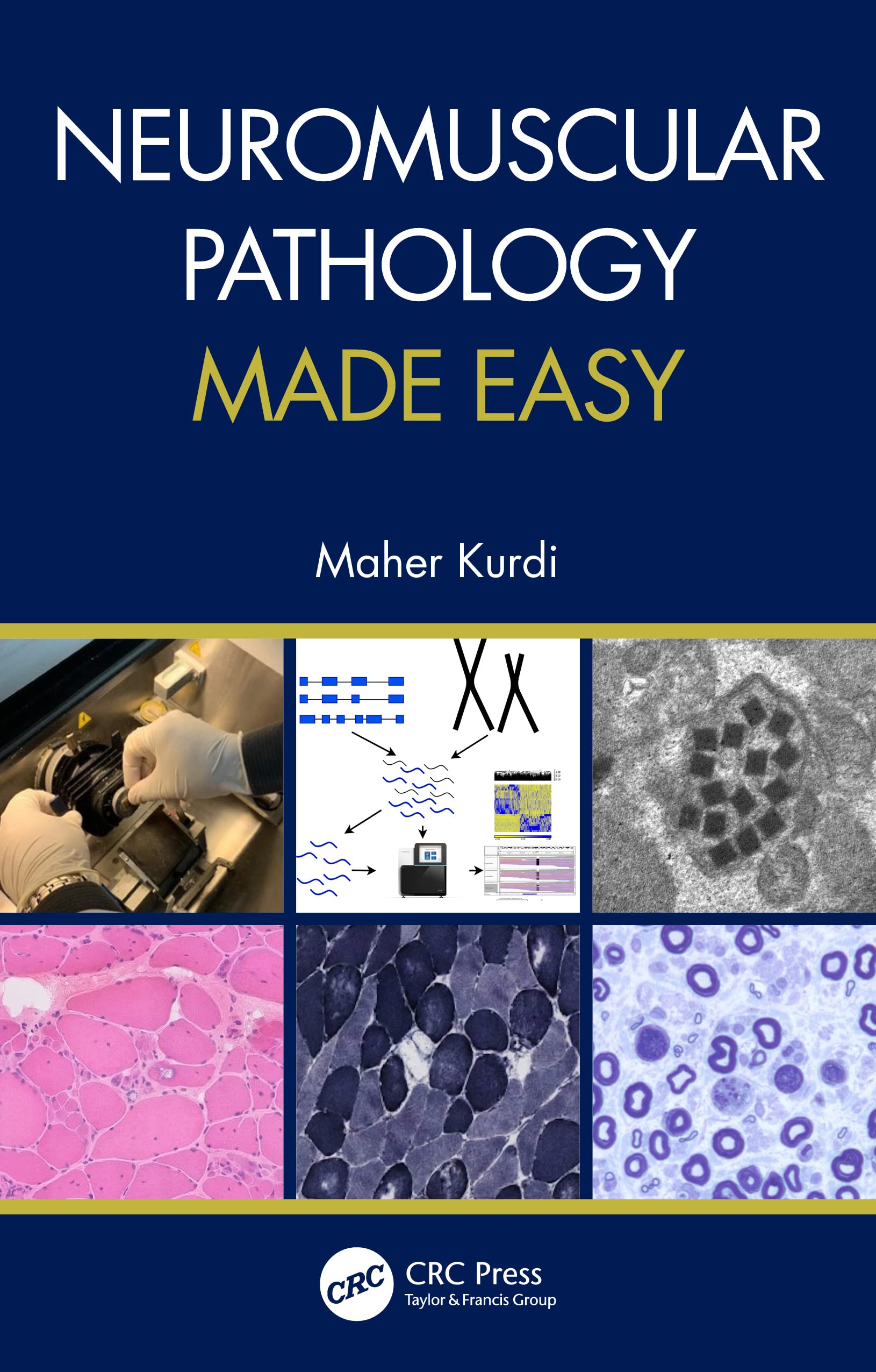 NEUROMUSCULAR PATHOLOGY MADE EASY (PB 2021)