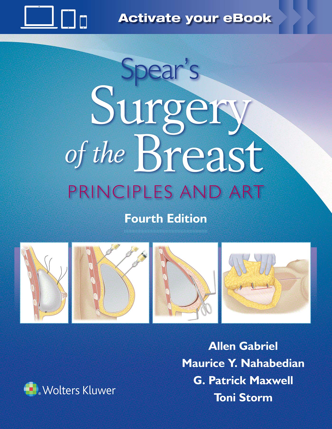 Spears Surgery of the Breast: Principles and Art