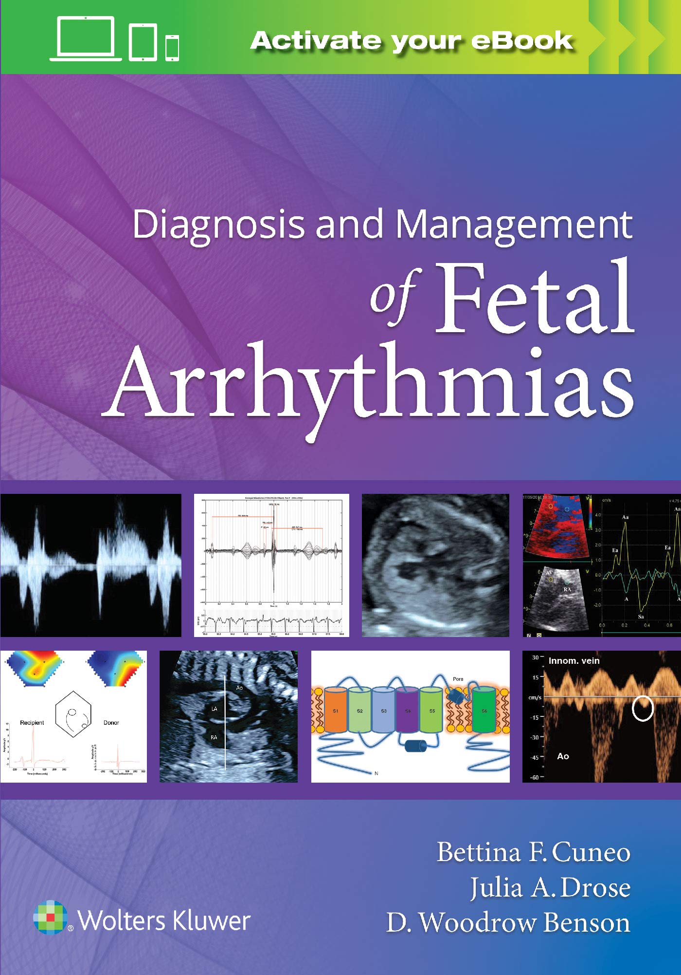 Diagnosis And Management Of Fetal Arrhythmias (Pb 2021)