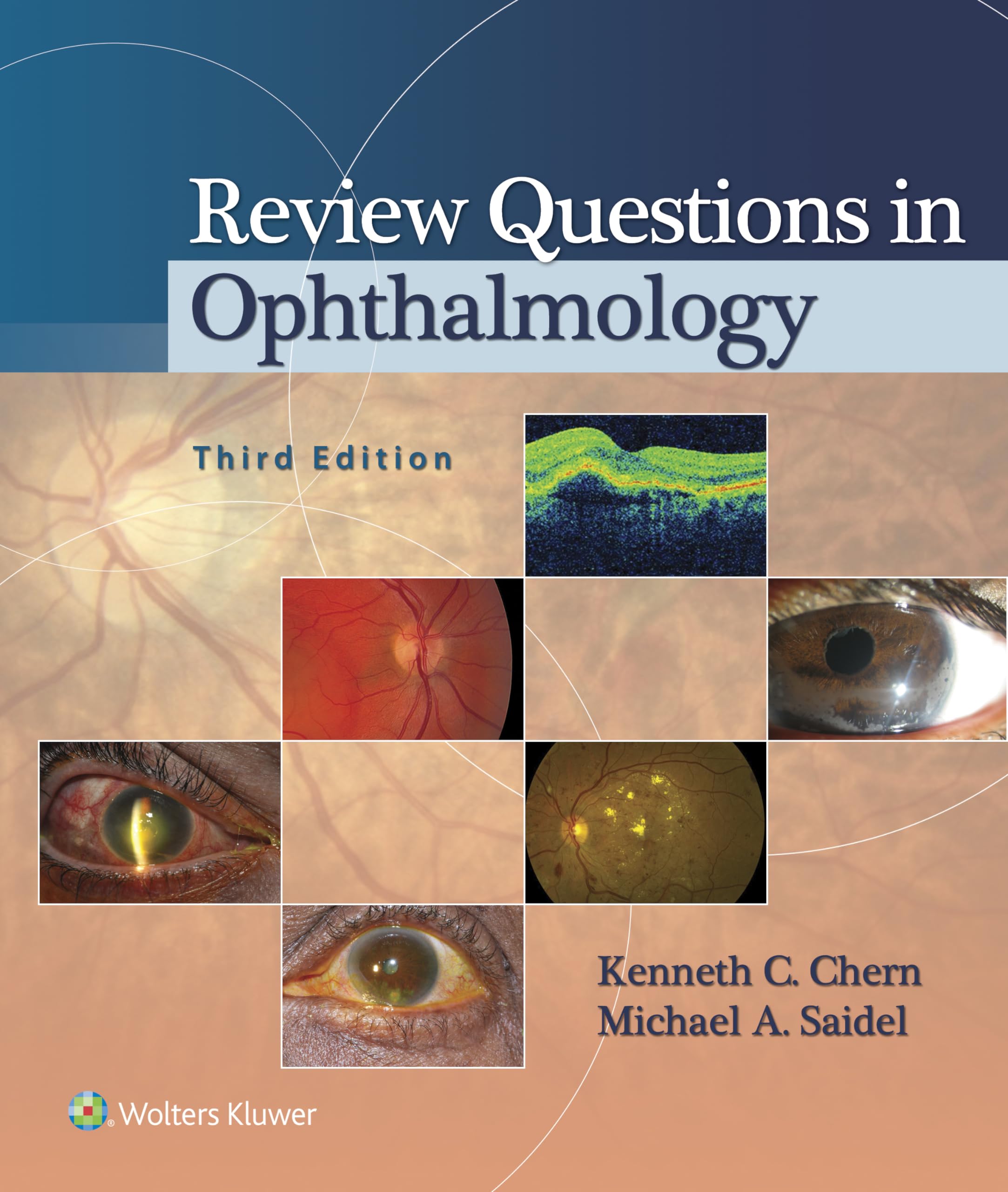 Review Questions In Ophthalmology 3Ed (Pb 2015)