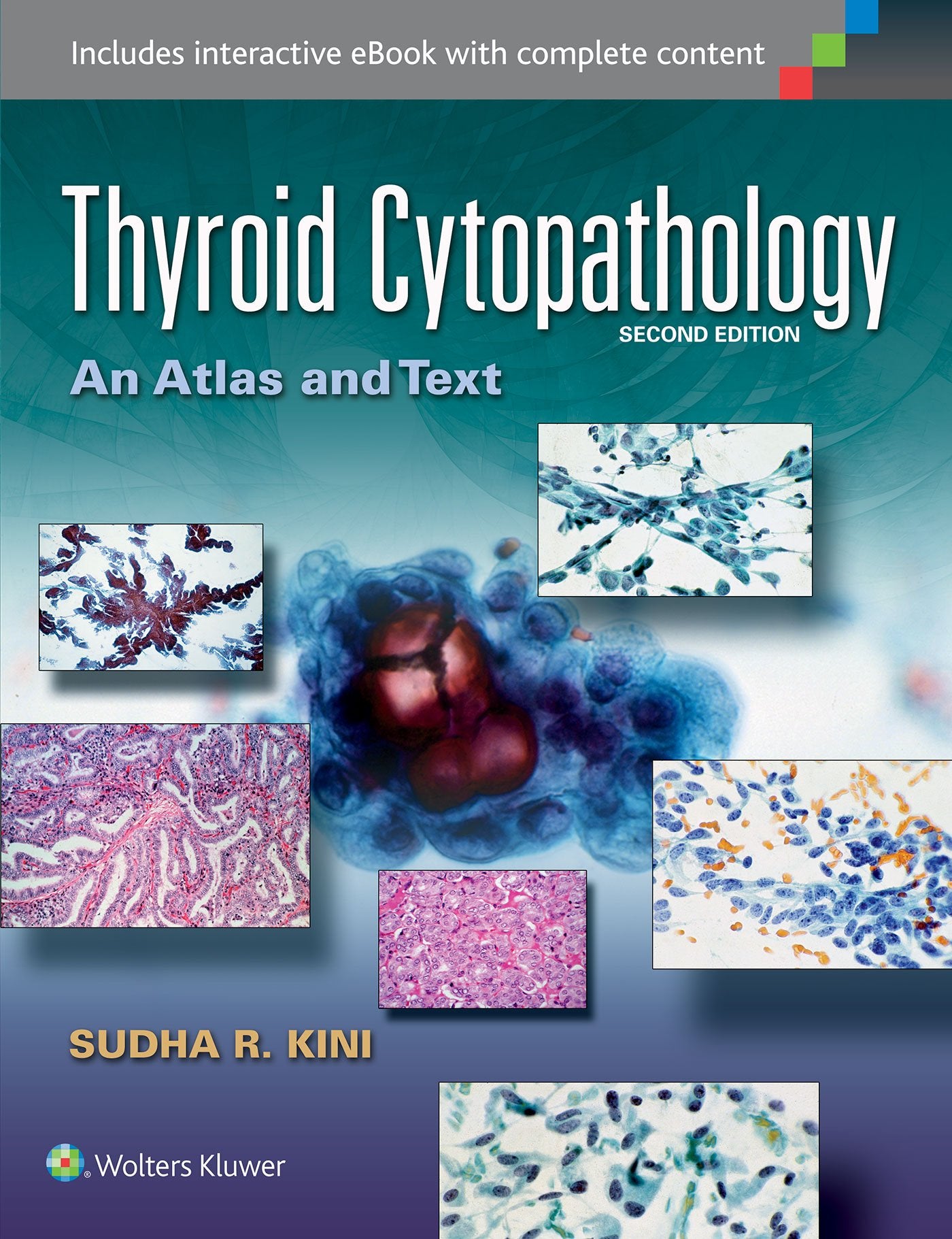 Thyroid Cytopathology An Atlas And Text 2Ed (Hb 2015)