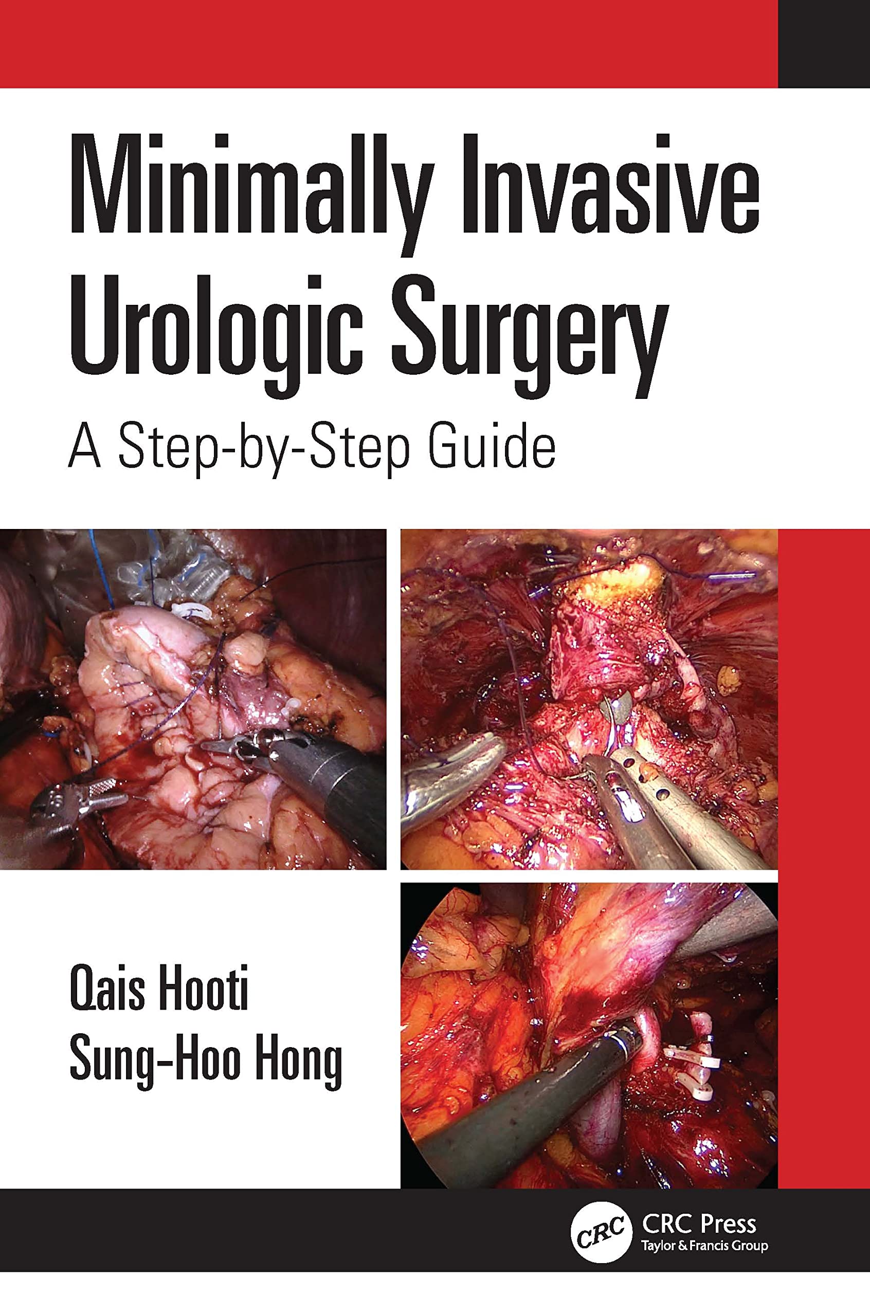 MINIMALLY INVASIVE UROLOGIC SURGERY A STEP BY STEP GUIDE (PB 2023)