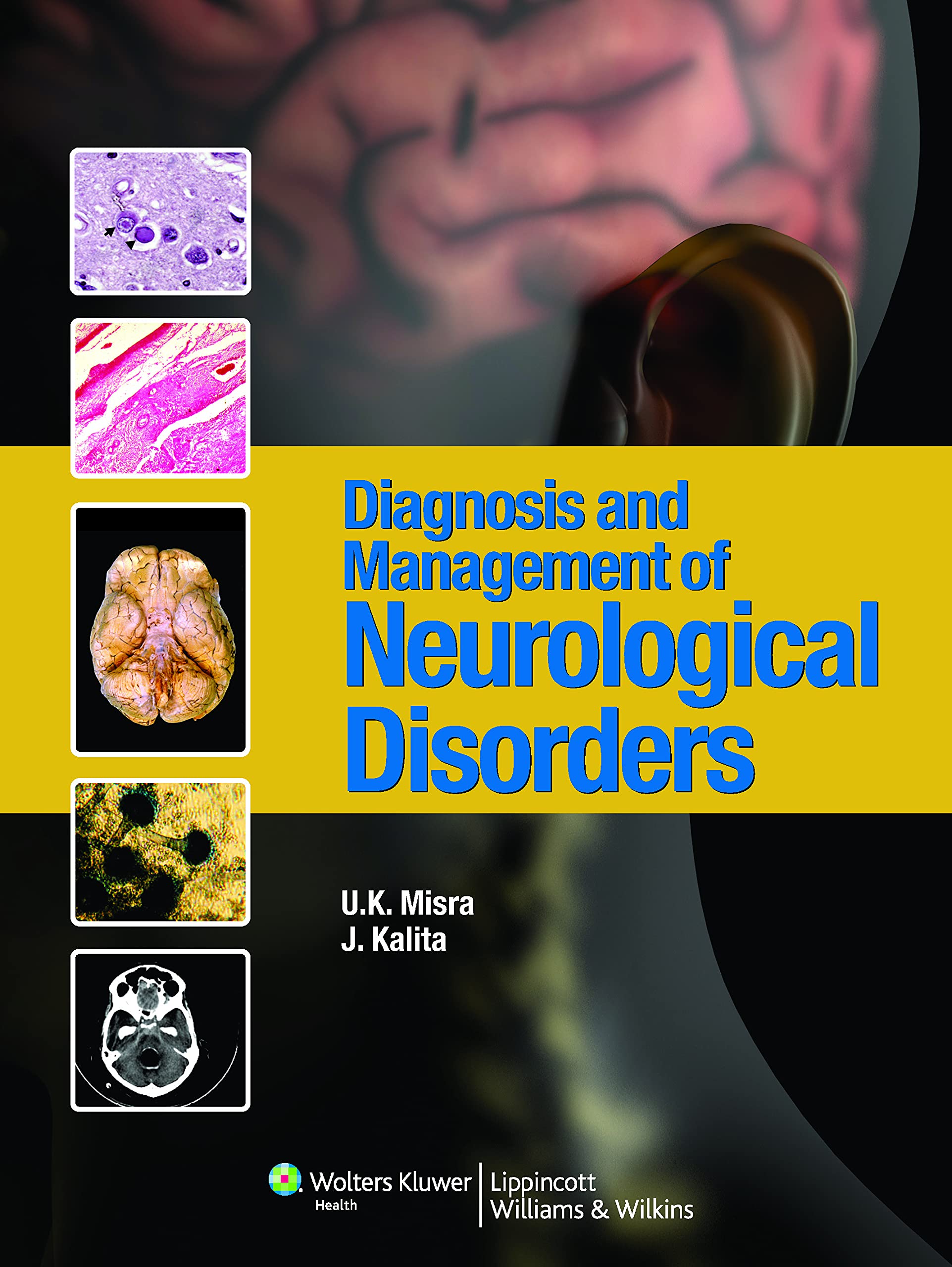 Diagnosis & Management of Neurological Disorders