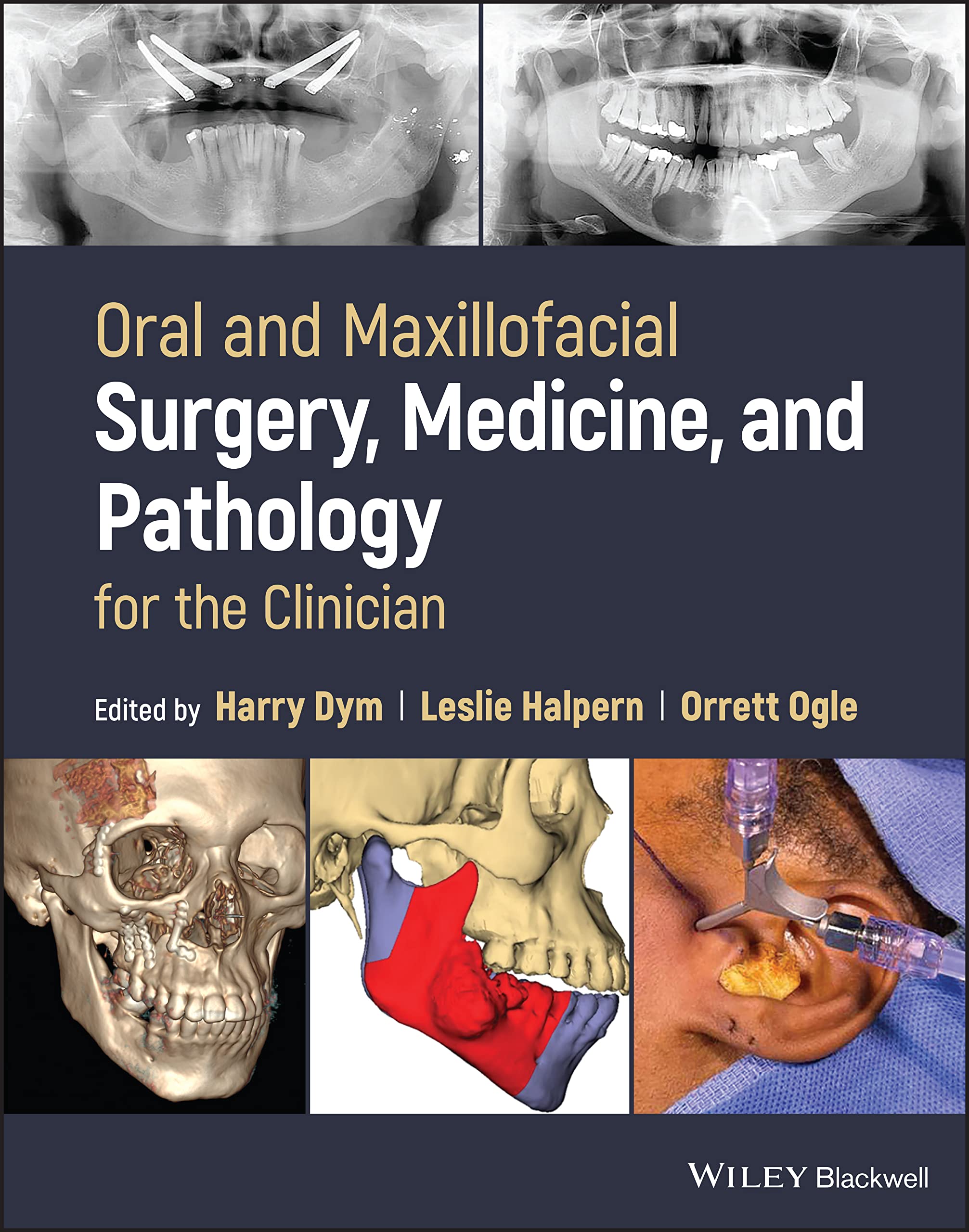 ORAL AND MAXILLOFACIAL SURGERY MEDICINE AND PATHOLOGY FOR THE CLINICIAN (HB 2023)