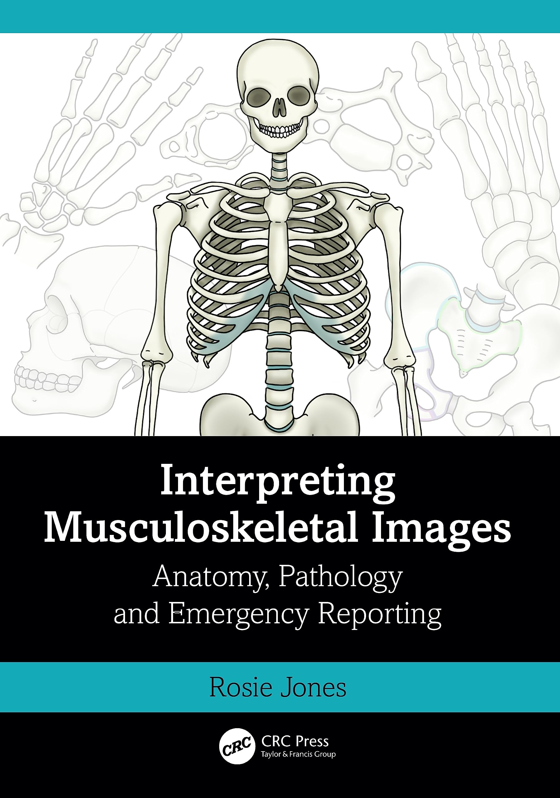Interpreting Musculoskeletal Images: Anatomy, Pathology And Emergency Reporting