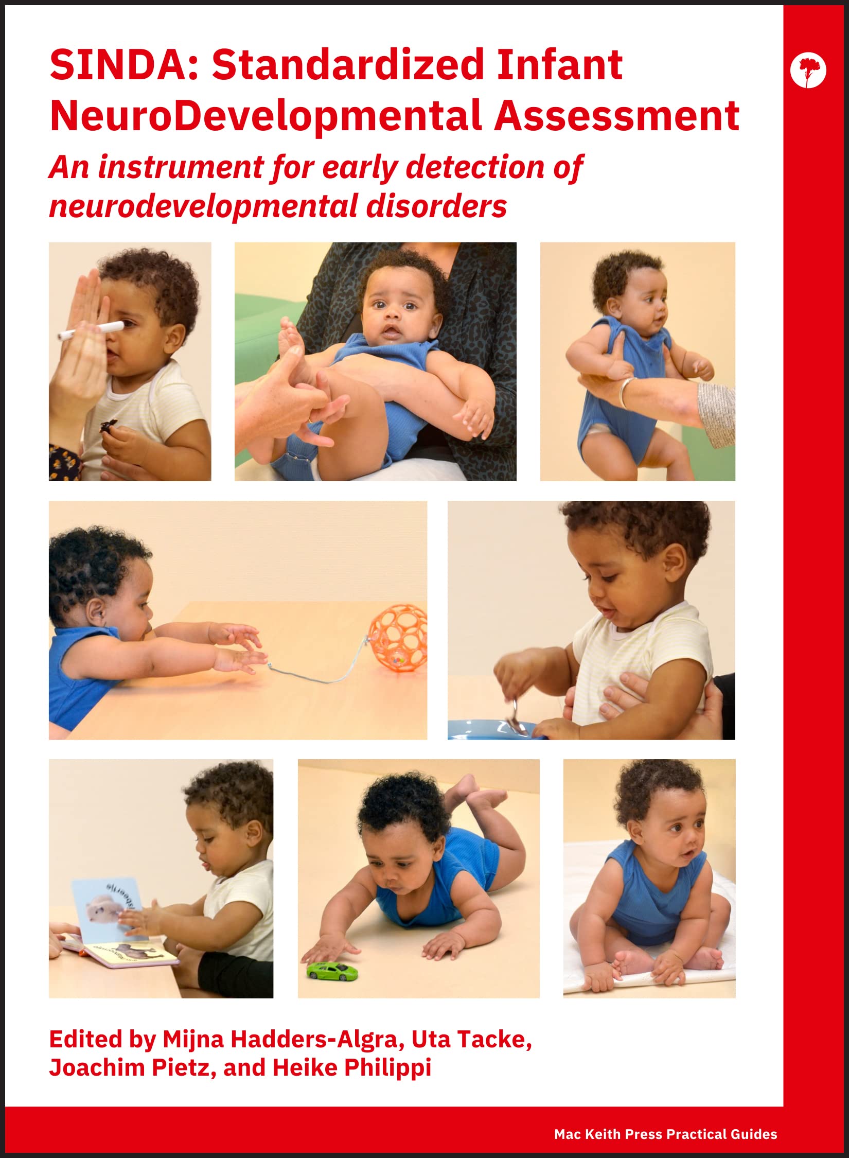 SINDA Standardized Infant NeuroDevelopmental Assessment: An Instrument for Early Detection of Neurodevelopmental Disorders (Mac 