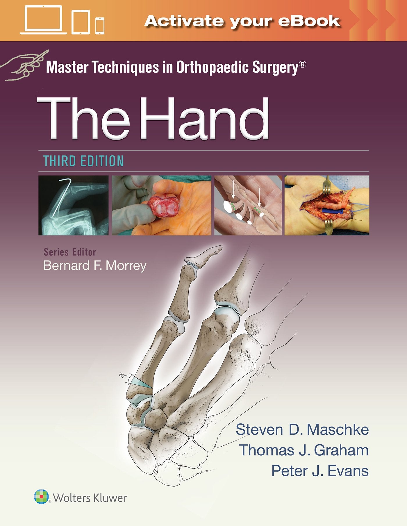 Master Techniques In Orthopaedic Surgery The Hand 3Ed (Hb 2016)