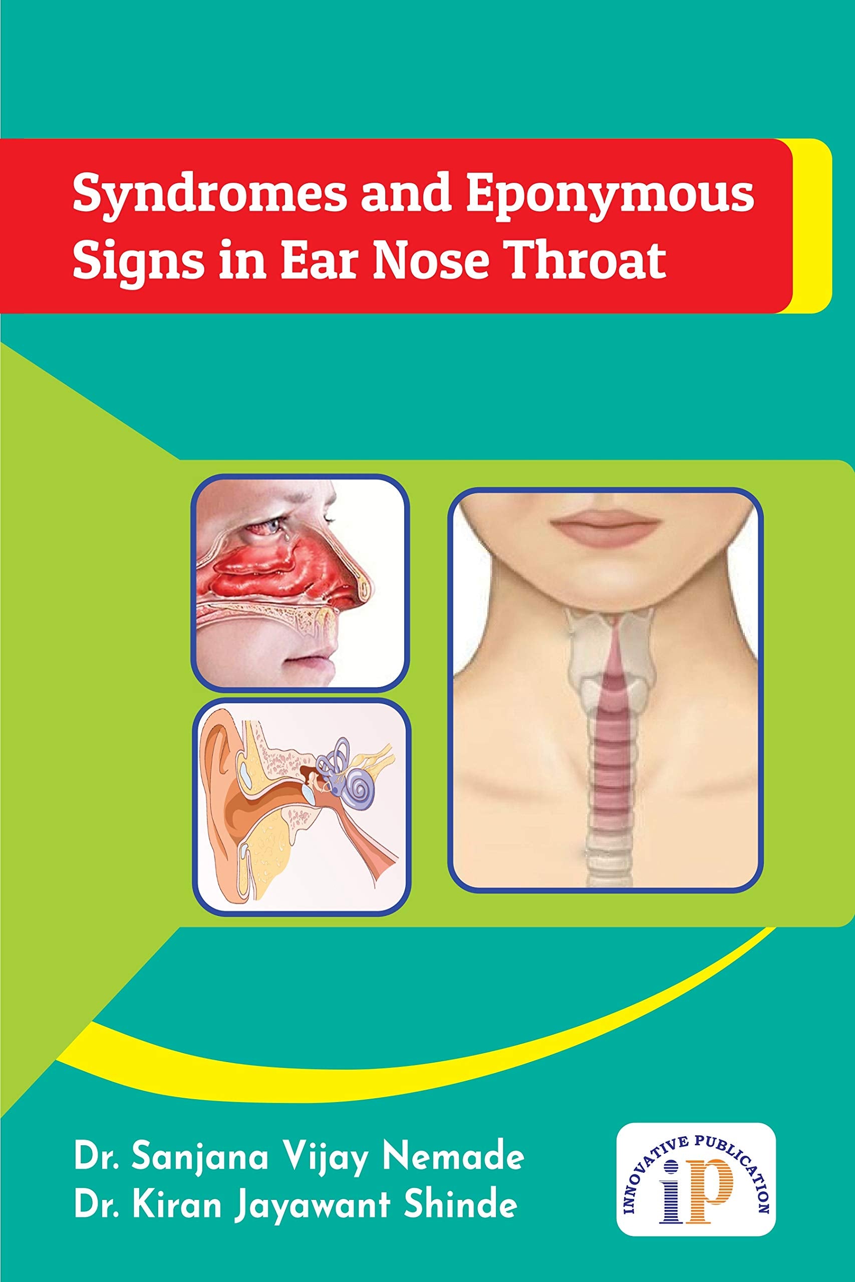 Syndromes and Eponymous Signs in Ear Nose Throat