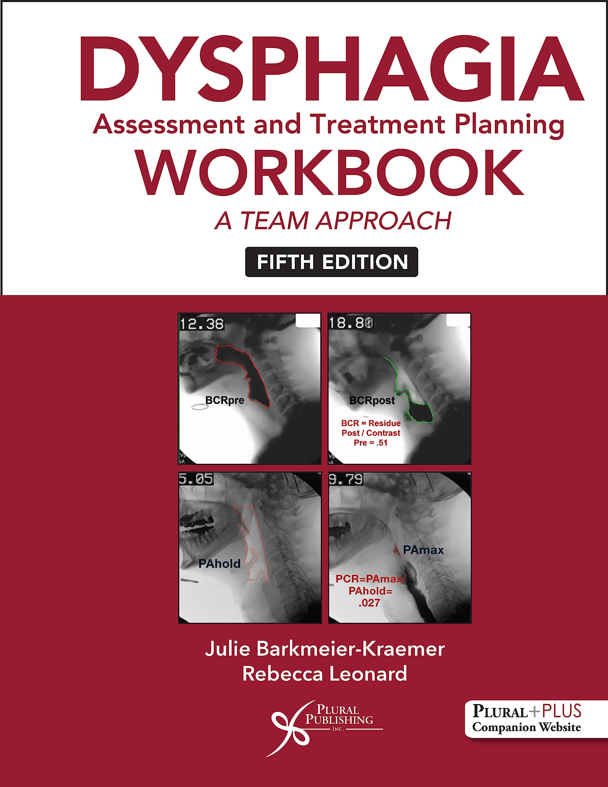 Dysphagia Assessment and Treatment Planning: A Team Approach (Dysphagia Assessment and Treatment Planning Workbook: A Team Appro