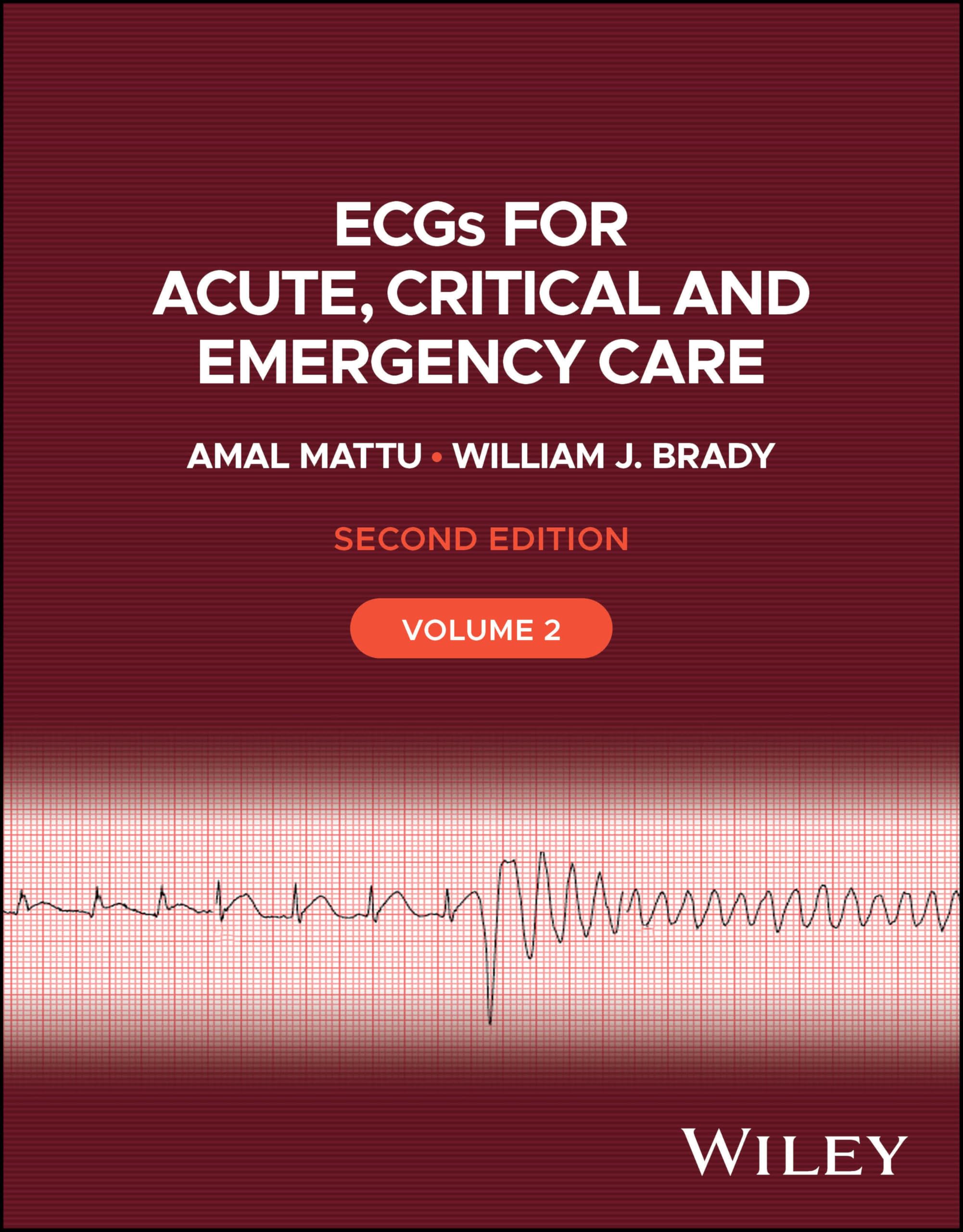 Ecgs for Acute, Critical and Emergency Care (2)