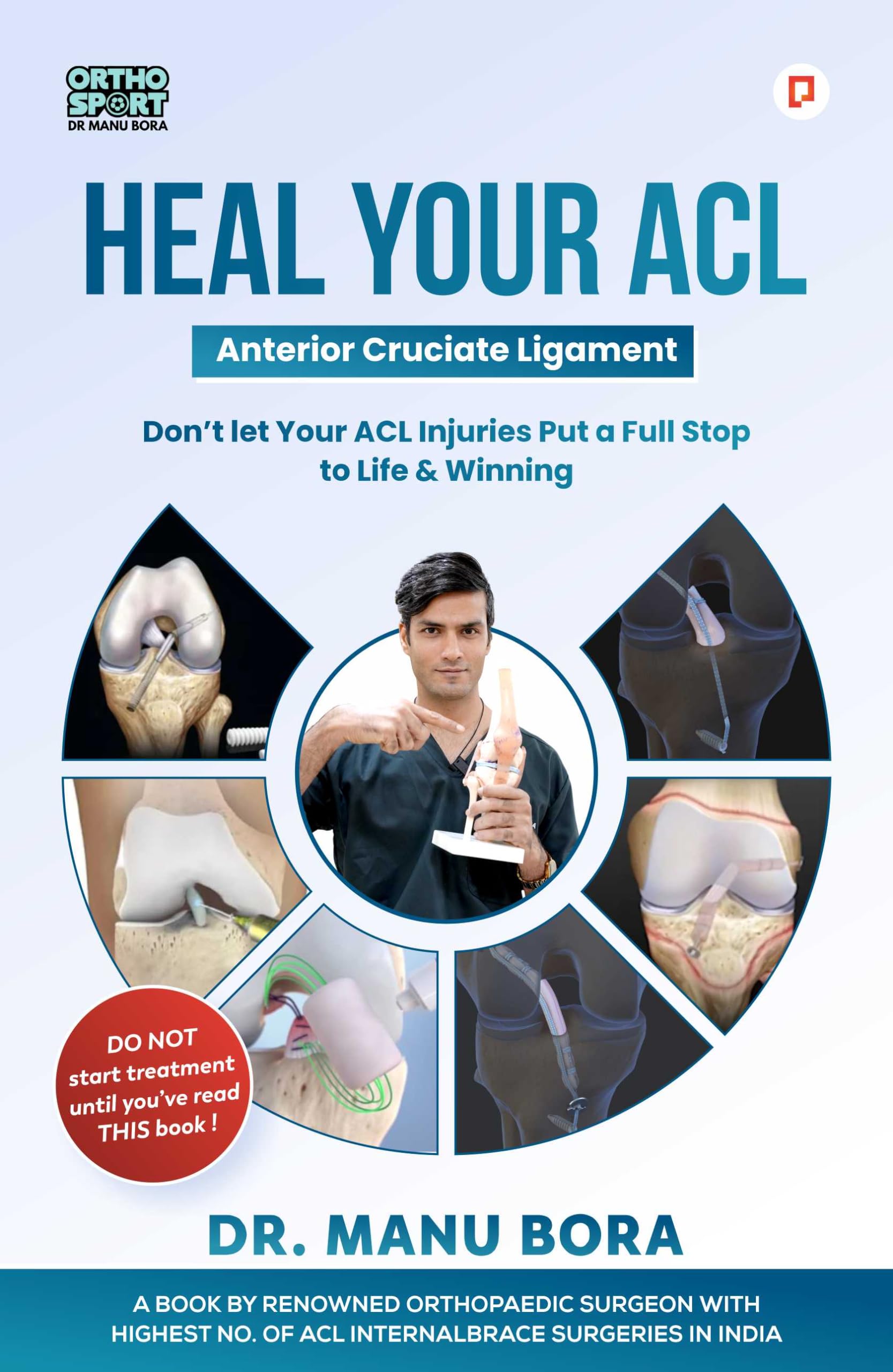 Heal Your ACL (Anterior Cruciate Ligament)