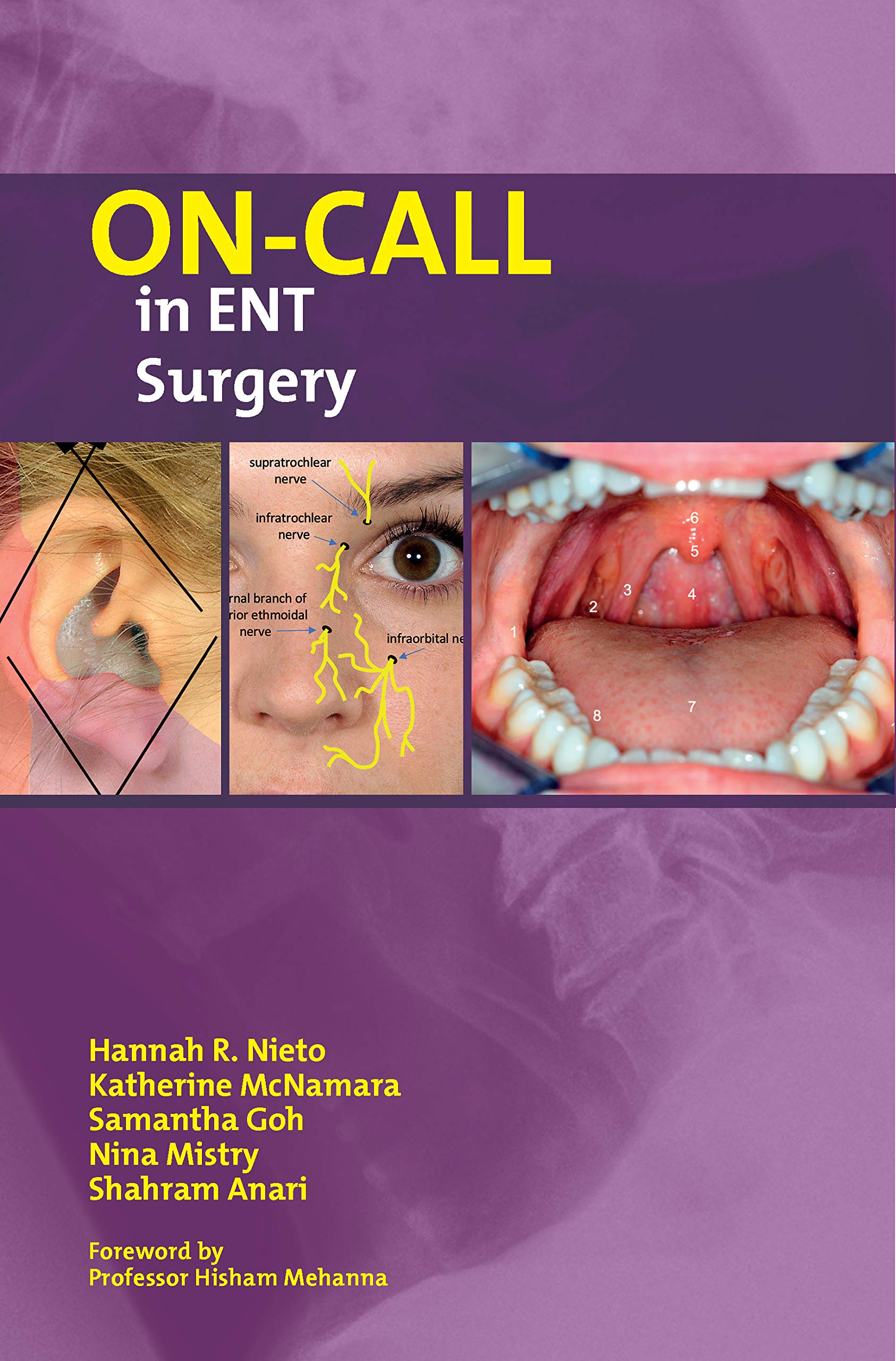 OnCall in ENT Surgery (OnCall Series)