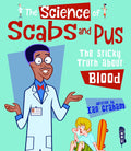 The Science Of Scabs & Pus: The Sticky Truth About Blood
