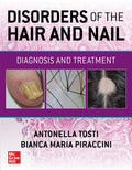 DISORDERS OF THE HAIR AND NAIL DIAGNOSIS AND TREATMENT (HB 2024)