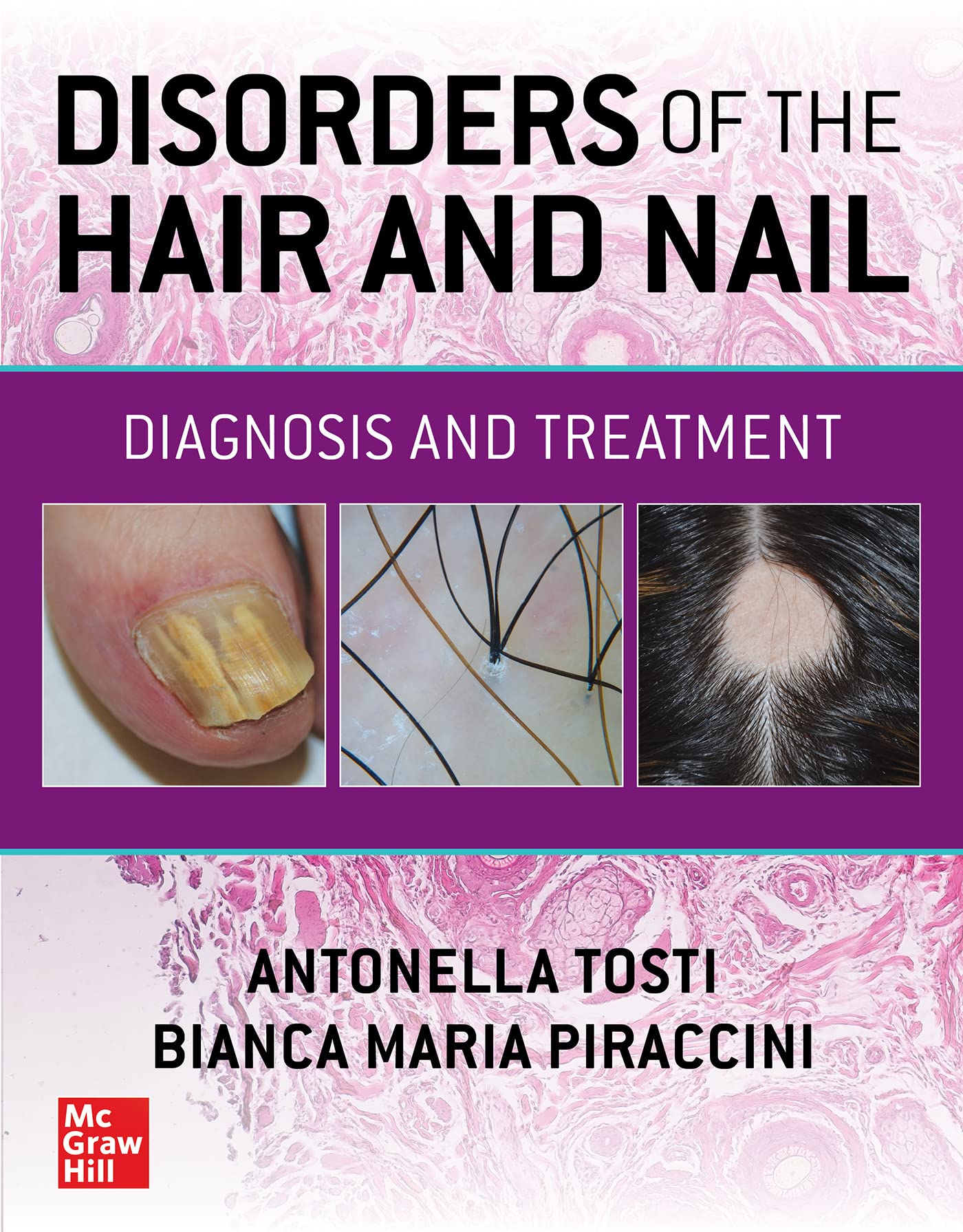 DISORDERS OF THE HAIR AND NAIL DIAGNOSIS AND TREATMENT (HB 2024)