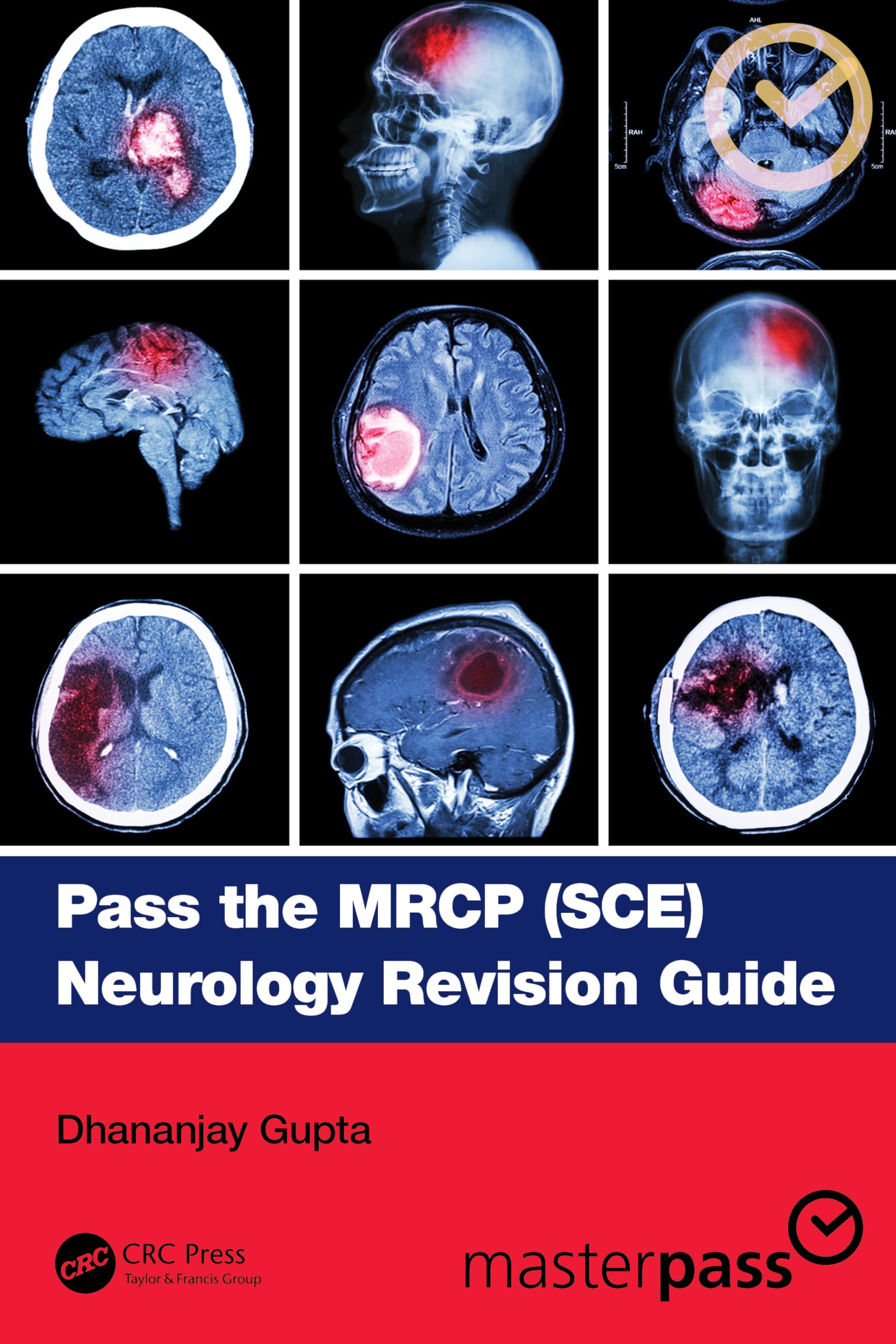 Pass The Mrcp Sce Neurology Revision Guide (Pb 2025) (Masterpass)