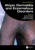 ATOPIC DERMATITIS AND ECZEMATOUS DISORDERS 2ED (HB 2026)