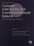 Rehabilitation of Complex Cleft Palate and Craniomaxiliofacial Effects: The Challenge of Bauru
