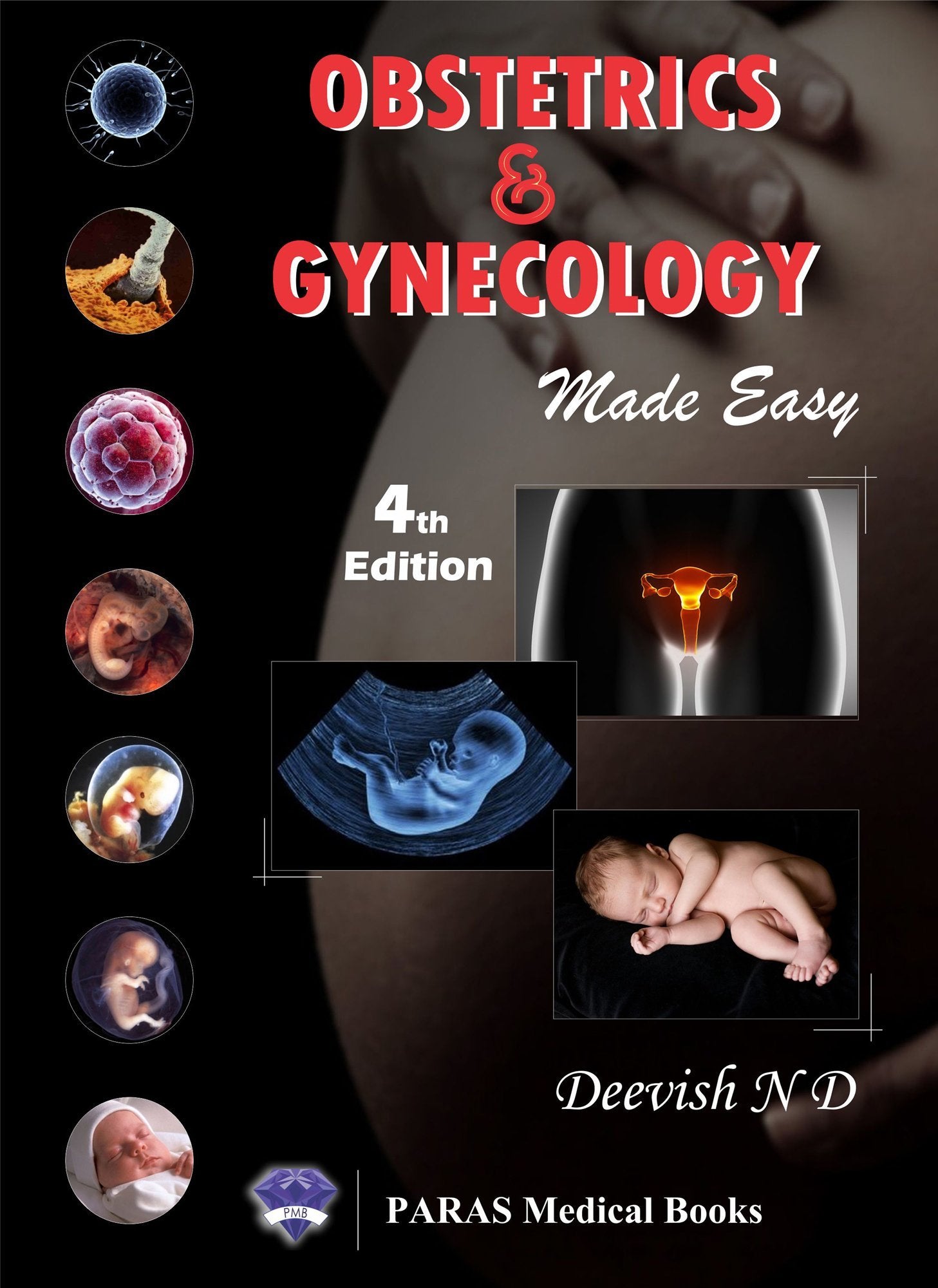 Obstetrics & Gynaecology Made Easy, Deevish  3rd, 2016.0