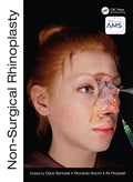 Non Surgical Rhinoplasty (Hb 2023) (The Prime Series)