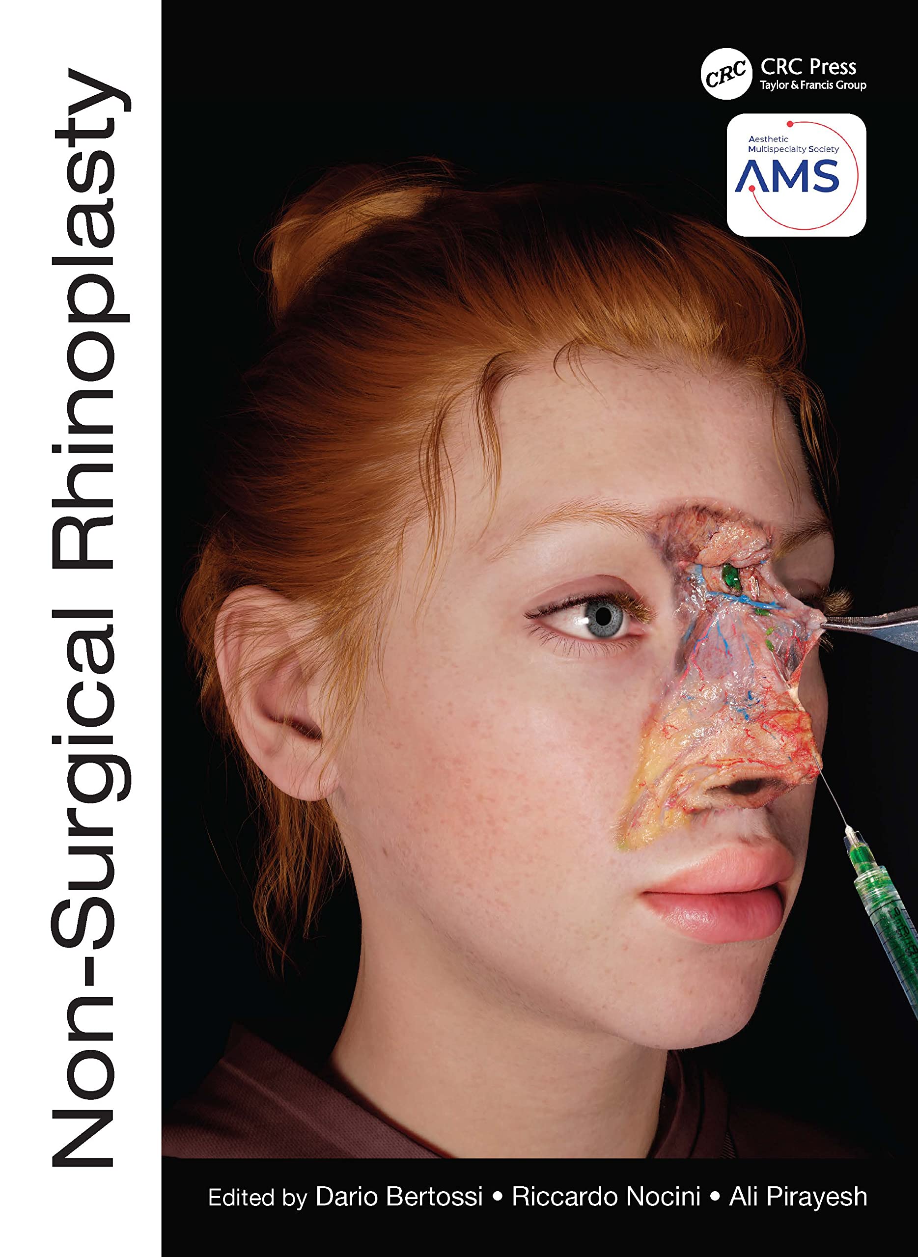 Non Surgical Rhinoplasty (Hb 2023) (The Prime Series)