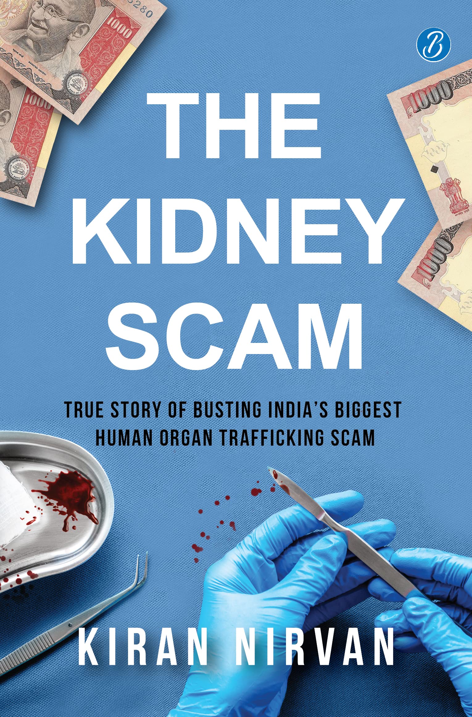 The Kidney Scam: True story of busting Indias biggest human organ trafficking scam  A true crime that shocked the nation