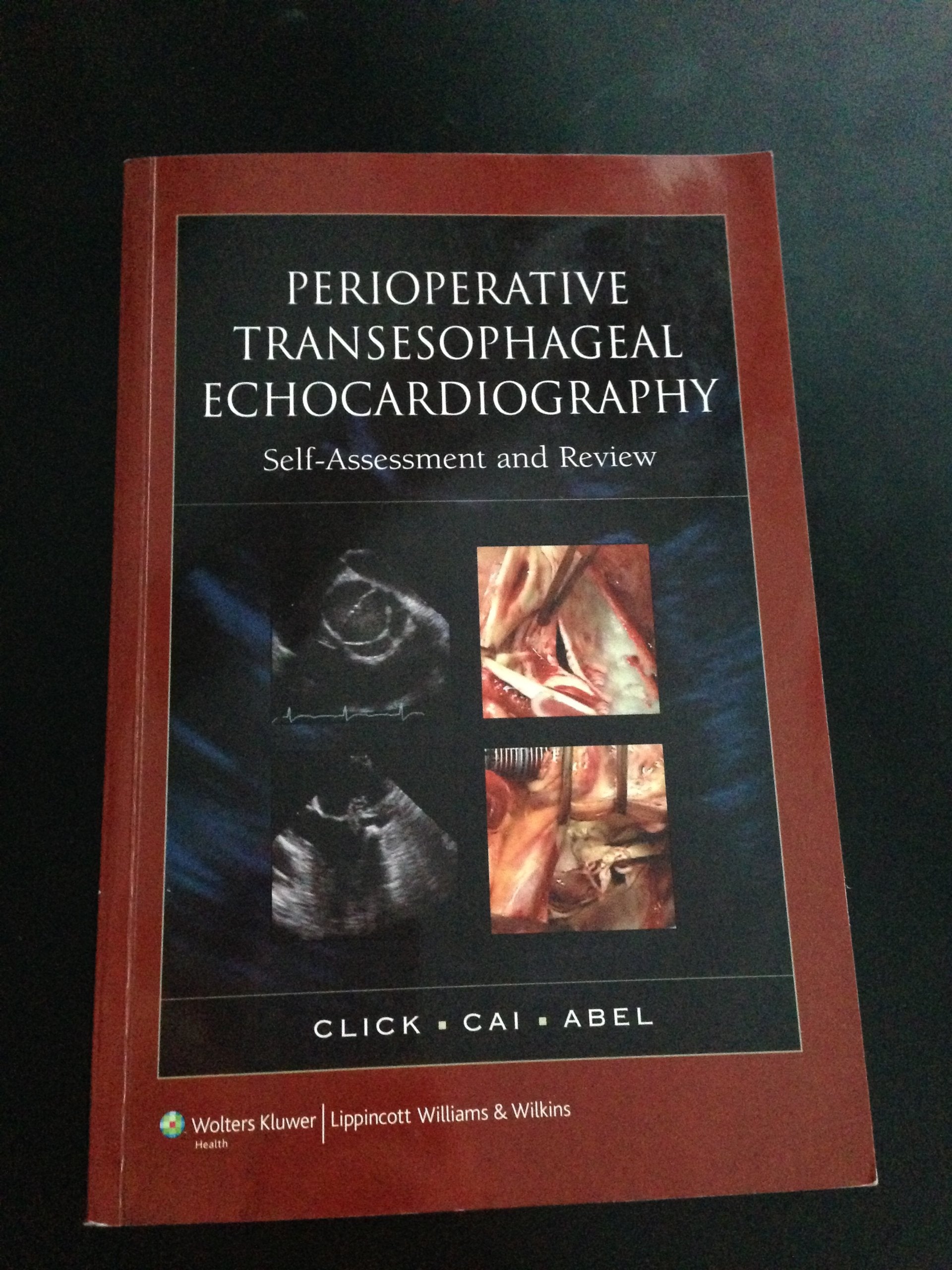 Perioperative Transesophageal Echocardiography SelfAssessment and Review