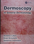 Dermoscopy In General Dermatology