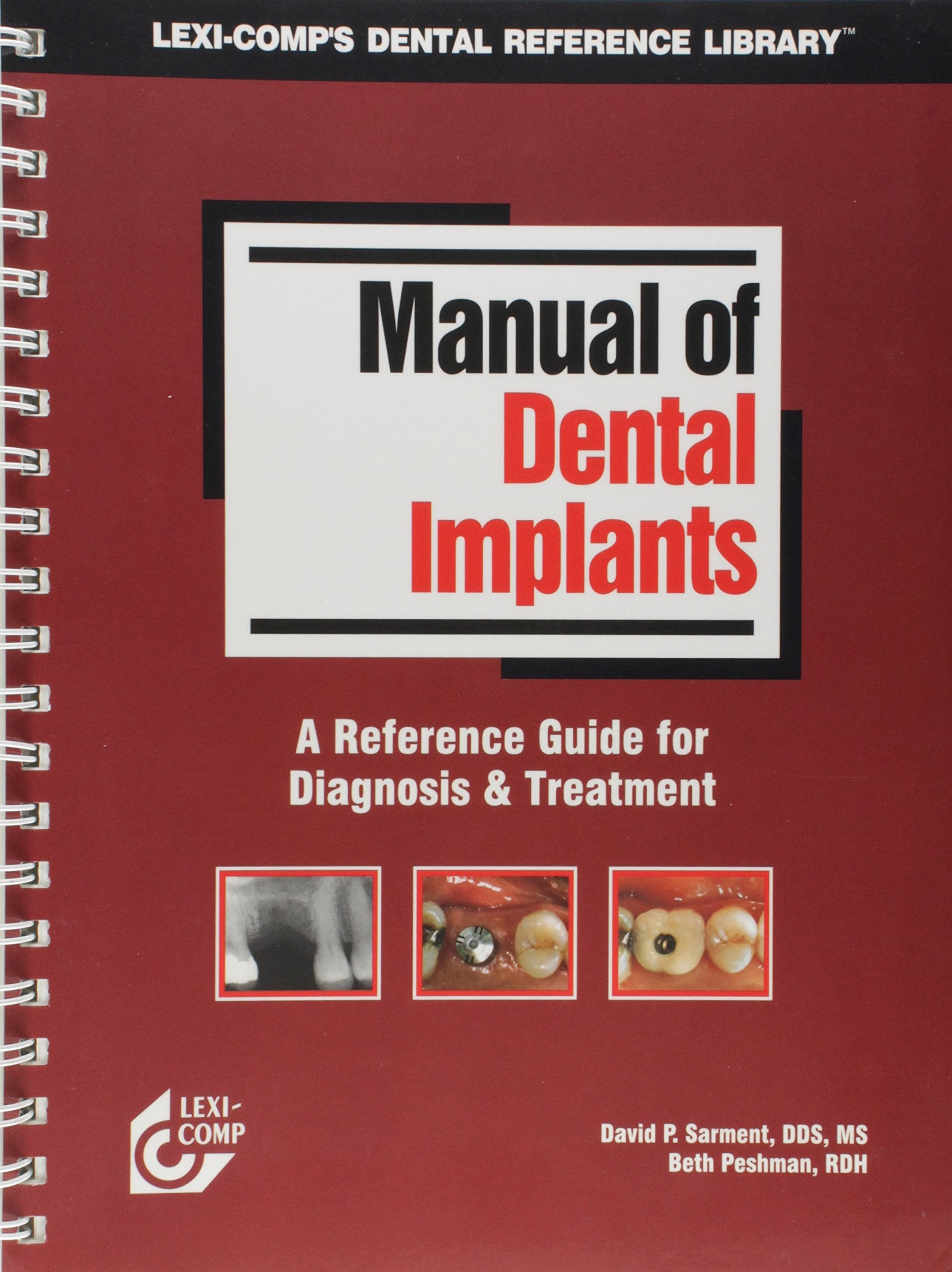 Manual Of Dental Implants