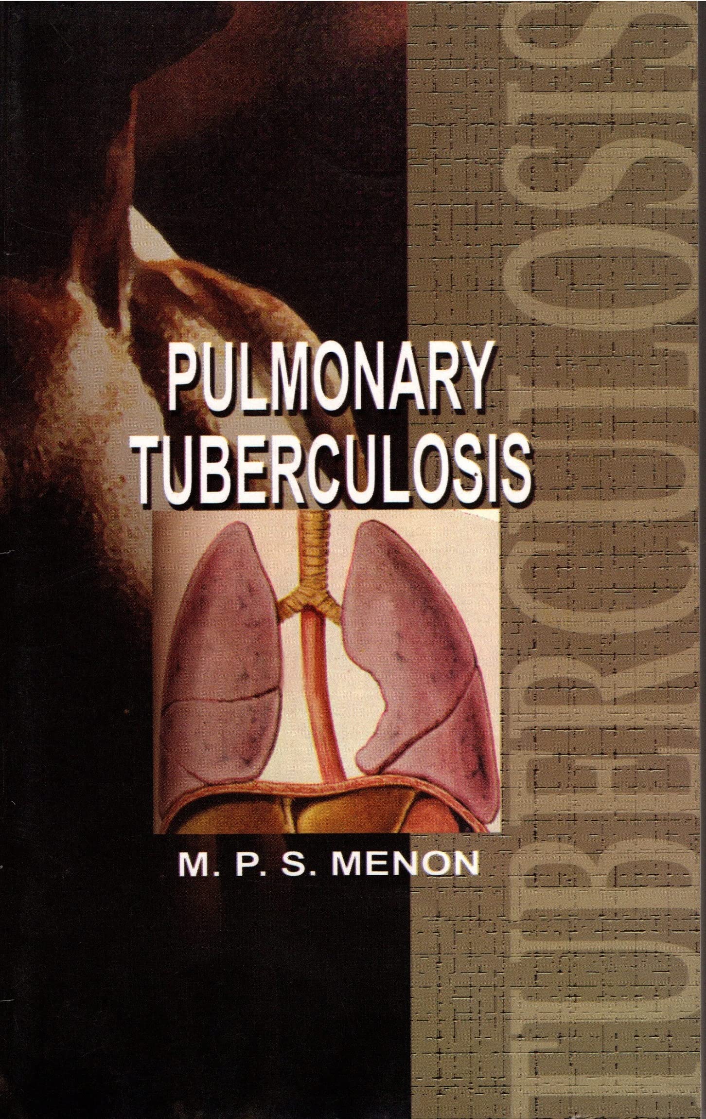 Pulmonary Tuberculosis