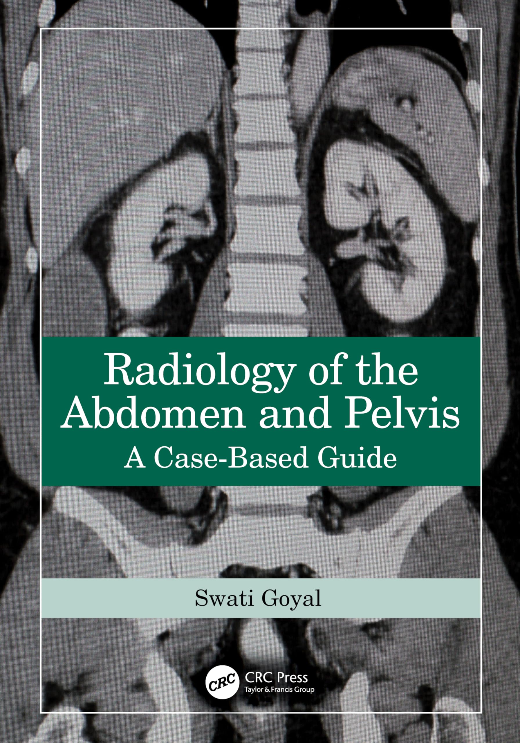 Radiology Of The Abdomen And Pelvis: A CaseBased Guide