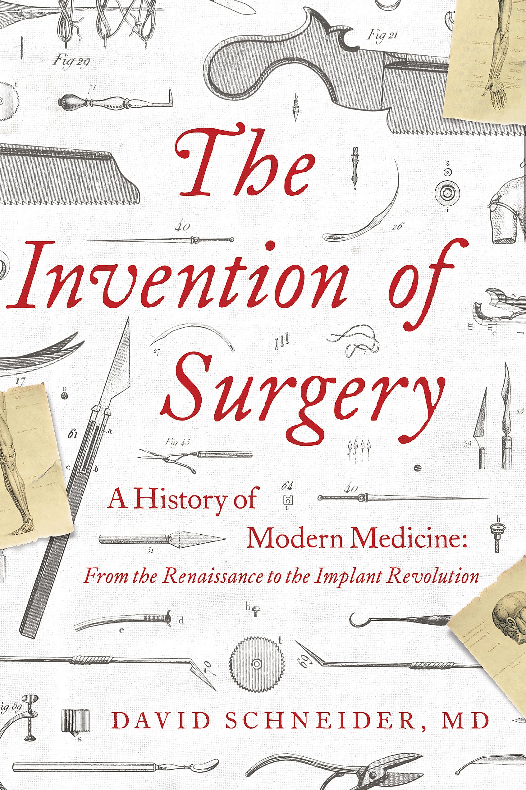 The Invention Of Surgery