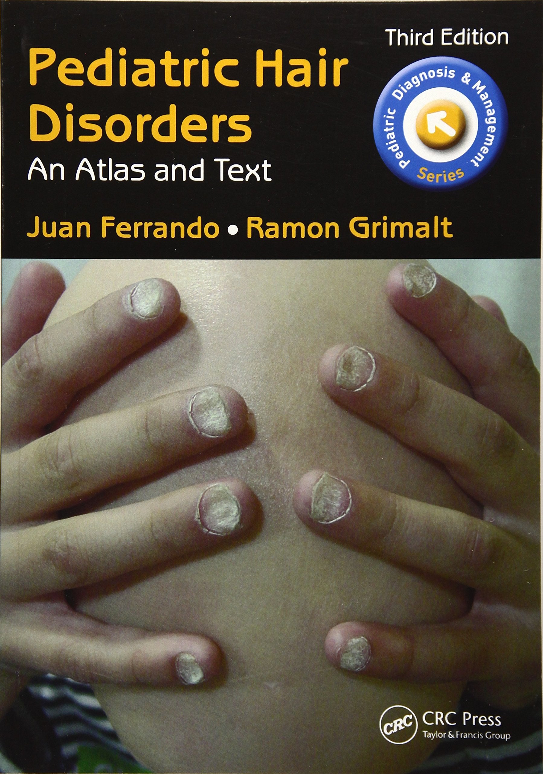 Pediatric Hair Disorders An Atlas And Text 3Ed (Pb 2017) (Pediatric Diagnosis And Management)