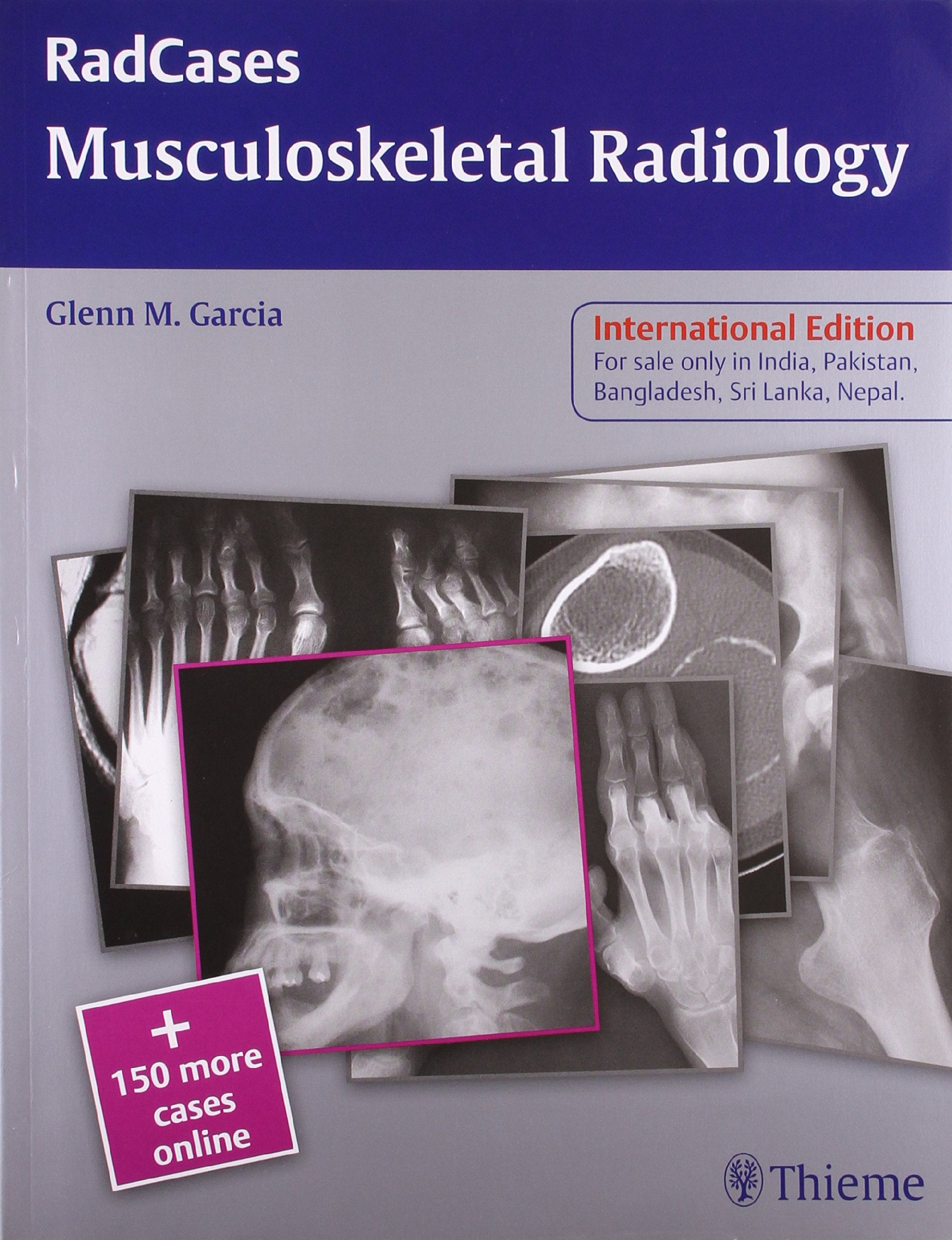 Radcases: Musculoskeletal Radiology (Ie)