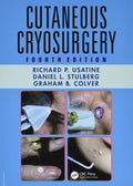 Cutaneous Cryosurgery: Principles And Clinical Practice